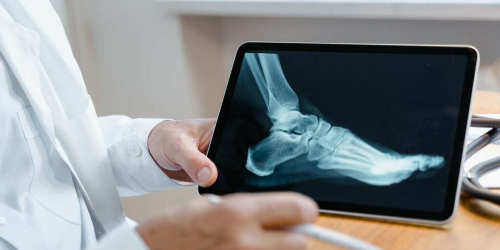 Radiographie du pied