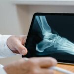 Quelles différences entre une fracture et une luxation ?